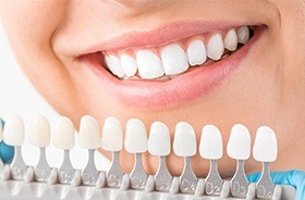 Smile compared with tooth color chart