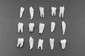 Extracted teeth arranged against dark background 