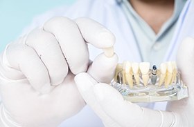 Hamden implant dentist holding model jaw with dental implant and restoration