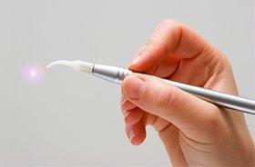 Hand holding laser dentistry tool