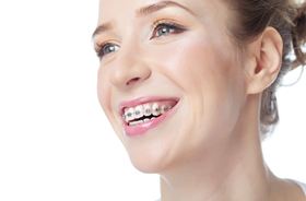 Smiling green-eyed woman with braces against white background