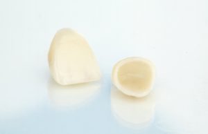 Two lost dental crowns in Hamden on reflective surface