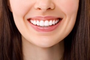 Close-up of woman’s beautiful smile with veneers